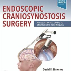 Endoscopic Craniosynostosis Surgery (First ed/1e) : An Illustrated Guide to Endoscopic Techniques 1st Edition