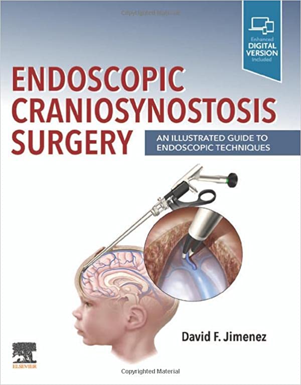 Endoscopic Craniosynostosis Surgery (First ed/1e) : An Illustrated Guide to Endoscopic Techniques 1st Edition