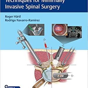 Essential Step-by-Step Techniques for Minimally Invasive Spinal Surgery (1st ed/1e) First Edition