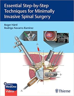 Essential Step-by-Step Techniques for Minimally Invasive Spinal Surgery (1st ed/1e) First Edition