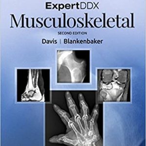 ExpertDDx: Musculoskeletal [EXPERT DDX 3e/second ed] 2nd Edition