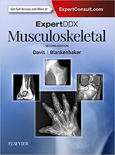ExpertDDx: Musculoskeletal [EXPERT DDX 3e/second ed] 2nd Edition