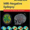 MRI-Negative Epilepsy Evaluation and Surgical Management (PDF 1e, first ed) 1st Edition