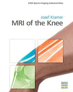 MRI of the Knee by Josef Kramer (Author, Editor)