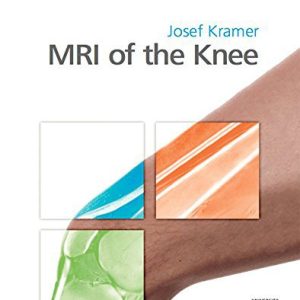 MRI of the Knee by Josef Kramer (Author, Editor)