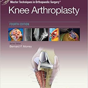 Master Techniques in Orthopedic Surgery: Knee Arthroplasty (4TH Ed/4e) Fourth Edition