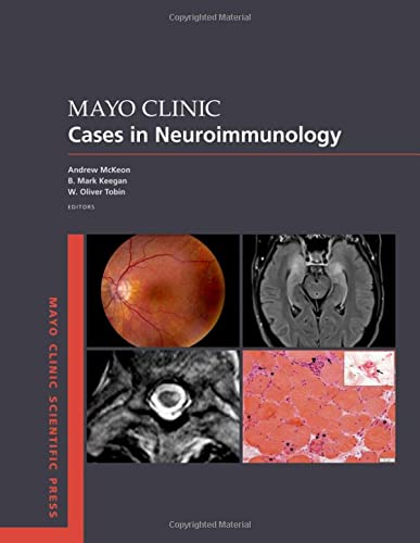 Mayo Clinic Cases in Neuroimmunology {ORIGINAL PDF}