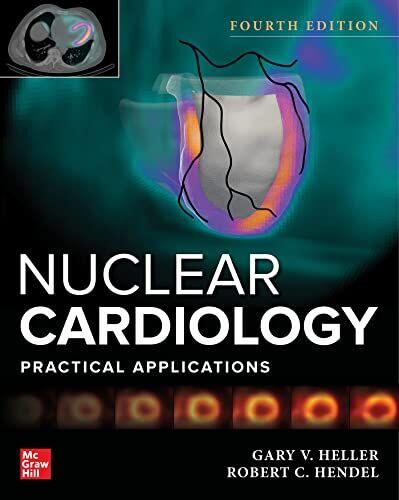 Nukleare Kardiologie: Praktische Anwendungen Vierte Auflage [Nukleare Kardiologie 4. Auflage 4e]