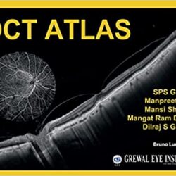 OCT Atlas [1st Ed/1e], First Edition by SPS Grewal, Manpreet Brar, Mansi Sharma, Mangat Ram Dogra & Dilraj S Grewal-AUTHORS
