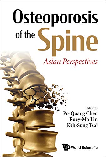 Osteoporose der Wirbelsäule Asiatische Perspektiven ERSTE Auflage 1e/1. Aufl