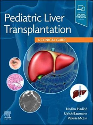 Pediatric Liver Transplantation: A Clinical Guide, [first ed] 1st Edition