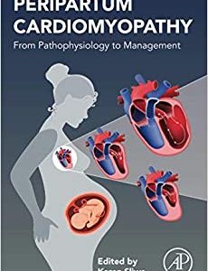 Peripartum Cardiomyopathy: From Pathophysiology to Management, (first ed) 1st Edition