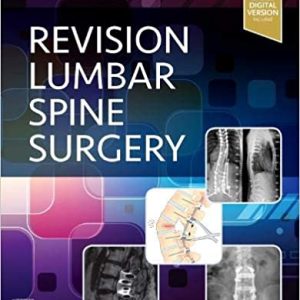 Revision Lumbar Spine Surgery [1e/1st ed] First Edition