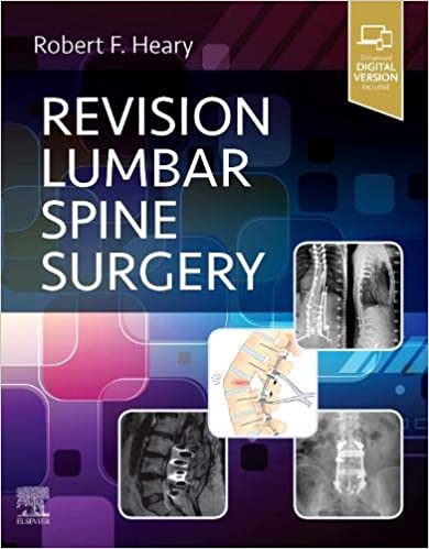 Revision Lumbar Spine Surgery [1e/1st ed] First Edition