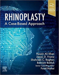 Rhinoplasty: [1e/first ed] a Case-based approach 1st Edition