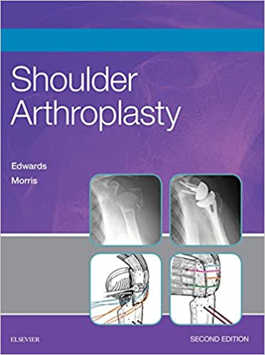 Shoulder Arthroplasty, (2nd ed/2e) SECOND Edition