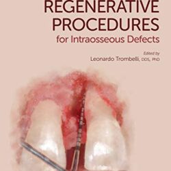 Simplified Regenerative Procedures for Intraosseous Defects (1e, first ed) 1st Edition