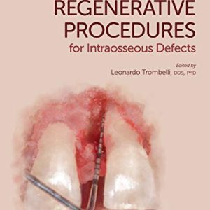 Simplified Regenerative Procedures for Intraosseous Defects (1e, first ed) 1st Edition