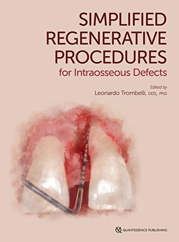 Simplified Regenerative Procedures for Intraosseous Defects (1e, first ed) 1st Edition