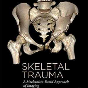 Skeletal Trauma: A Mechanism Based Approach of Imaging First Edition 1st ed 1e