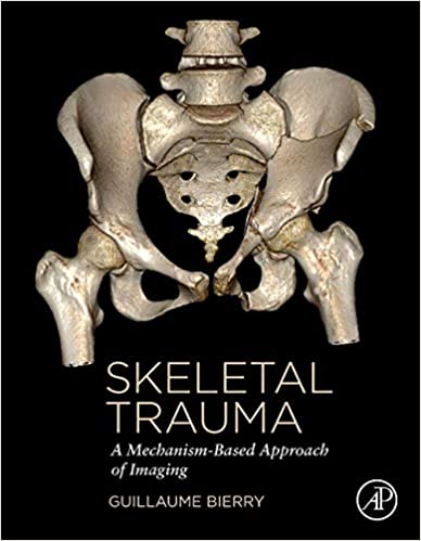Traumatisme squelettique : une approche de l'imagerie basée sur un mécanisme Première édition 1ère éd 1e
