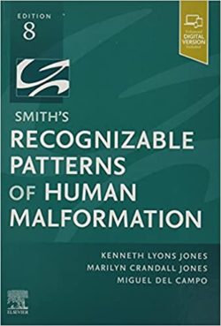 Smith’s {smiths} Recognizable Patterns of Human Malformation: Expert Consult [8e/eighth ed 8th Edition