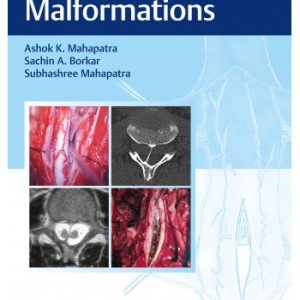 Split Cord Malformations (1st ed/1e) First Edition