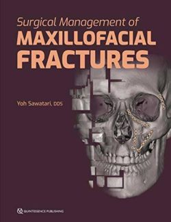 Surgical Management of Maxillofacial Fractures First Edition