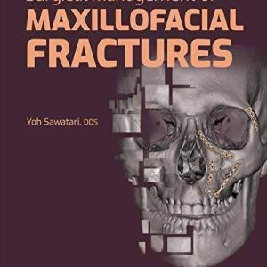 Surgical Management of Maxillofacial Fractures First Edition