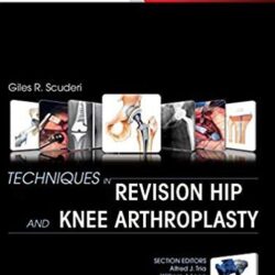 Techniques in Revision Hip and & Knee Arthroplasty (PDF 1e / first ed) 1st Edition