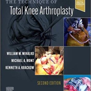 The Technique of Total Knee Arthroplasty (Second ed/2e) 2nd Edition