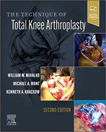 The Technique of Total Knee Arthroplasty (Second ed/2e) 2nd Edition