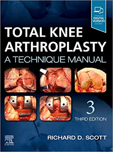 Total Knee Arthroplasty: A Technique Manual (3rd ed/3e) Third Edition
