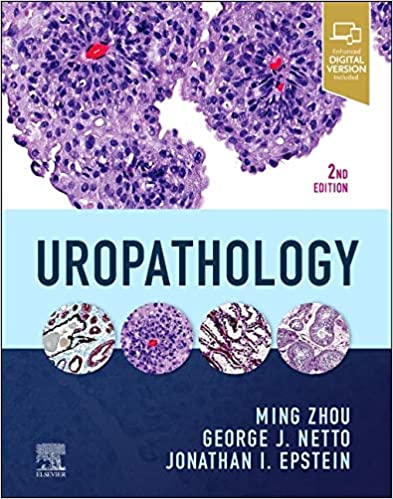 Uropathology (2nd ed/2e) Second Edition, by Ming Zhou MD PhD, George Netto MD & Jonathan I Epstein (Authors)