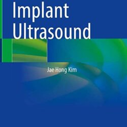 Atlas of Breast Implant Ultrasound First ed. 2022 Edition