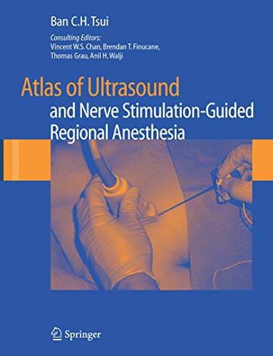 PDF EPUBAtlas of Ultrasound- and Nerve Stimulation-Guided Regional Anesthesia 2008th Edition