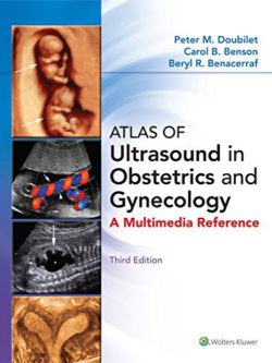 Atlas of Ultrasound in Obstetrics and Gynecology 3rd Edition (Third ed/3e) by Peter M. Doubilet MD PhD (Author), Carol B. Benson MD (Author), Beryl R. Benacerraf MD (Author)5.0 out of 5 stars 9 ratings