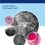Breast Cancer Mimics First Edition by Urszula Wegner (Author), Chitrangada Singh (Author)