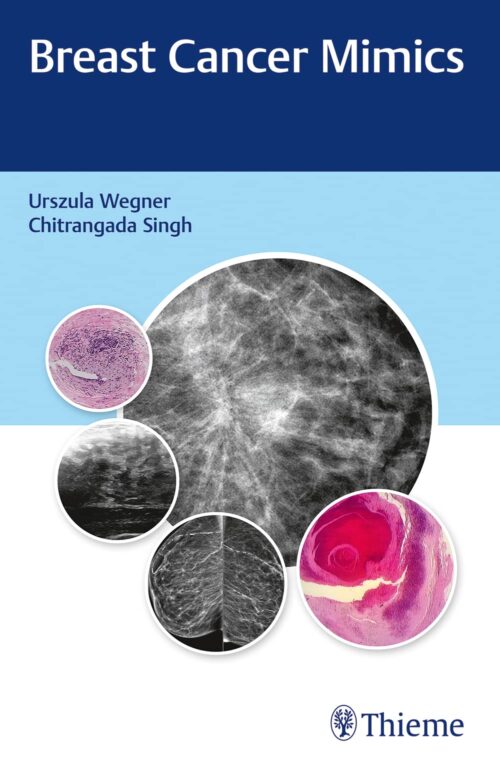 Breast Cancer Mimics First Edition by Urszula Wegner (Author), Chitrangada Singh (Author)
