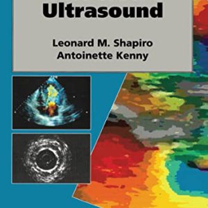 Cardiac Ultrasound (Kenny Antoinette,Leonard M. Shapiro) (Authors)