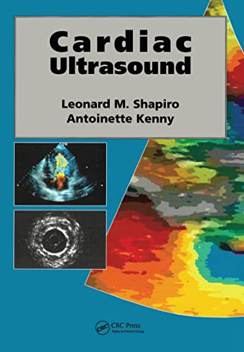 Ecografia cardiaca (Kenny Antoinette, Leonard M. Shapiro) (Autori)