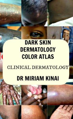Dark Skin Dermatology Color Atlas: Clinical Dermatology