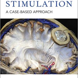 Deep Brain Stimulation A Case-based Approach First Edition (1st ed/1e)