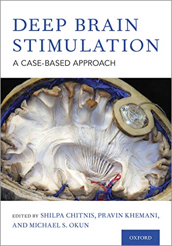 Deep Brain Stimulation A Case-based Approach First Edition (1st ed/1e)