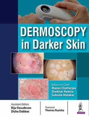 Dermoscopy in Darker Skin eBook
