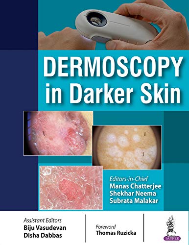 Dermoscopy in Darker Skin 1st Edition