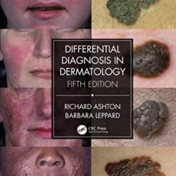 Differential Diagnosis in Dermatology Fifth Edition [5th ed/5e]