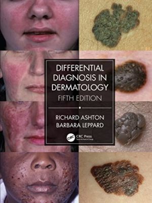Differential Diagnosis in Dermatology Fifth Edition [5th ed/5e]