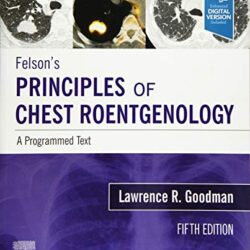 Felson's Principles of Chest Roentgenology, A Programmed Text: A Programmed Text 5th Edition by Lawrence R. Goodman MD FAAC (Author)