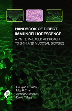 Handbook of Direct Immunofluorescence A Pattern-Based Approach to Skin and Mucosal Biopsies 1st Edition